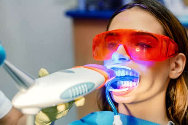 Simplifying Teeth Whitening: A Comprehensive Guide Slough