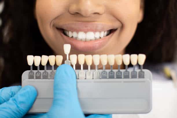 Laser Teeth Whitening: Exploring the Longevity of Your Brighter Smile Slough