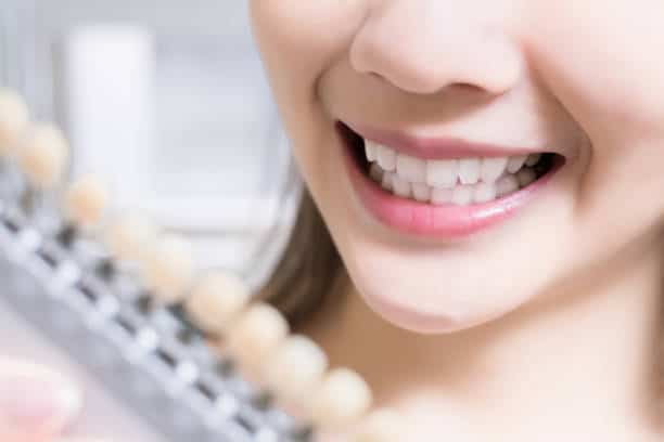 Teeth Whitening Kings Norton Slough