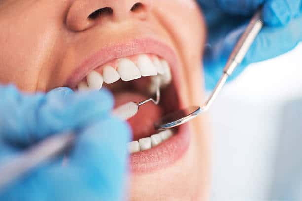 Get an Instant and Dazzling Smile with Laser Whitening Treatment Slough