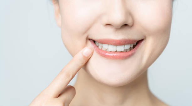 Comparing the Pain Factor: Laser Teeth Whitening vs. Zoom Teeth Whitening Slough