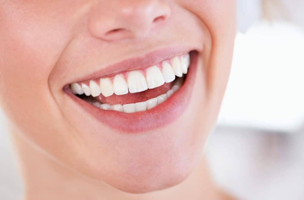 Teeth Whitening West Drayton Slough