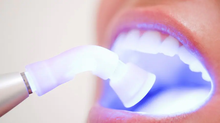 Teeth Whitening Aylesbury Slough