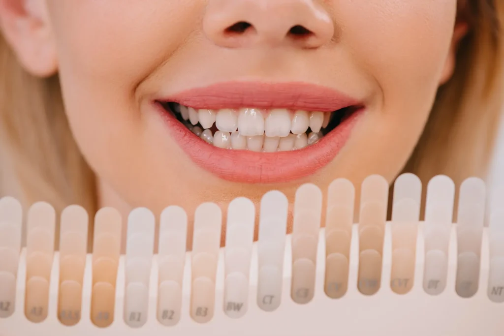 Bright white teeth reflecting light after a successful whitening session Slough